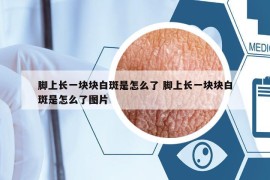 脚上长一块块白斑是怎么了 脚上长一块块白斑是怎么了图片