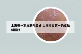 上海哪一家皮肤科最好 上海排名第一的皮肤科医院