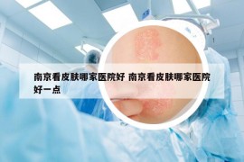 南京看皮肤哪家医院好 南京看皮肤哪家医院好一点