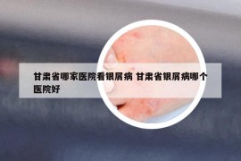 甘肃省哪家医院看银屑病 甘肃省银屑病哪个医院好