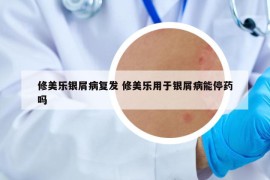 修美乐银屑病复发 修美乐用于银屑病能停药吗