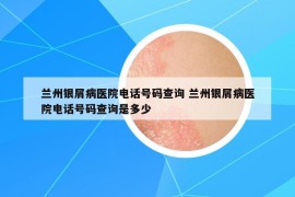 兰州银屑病医院电话号码查询 兰州银屑病医院电话号码查询是多少