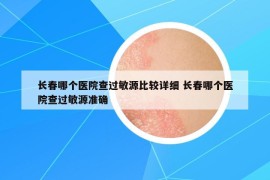 长春哪个医院查过敏源比较详细 长春哪个医院查过敏源准确
