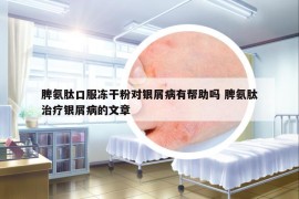 脾氨肽口服冻干粉对银屑病有帮助吗 脾氨肽治疗银屑病的文章