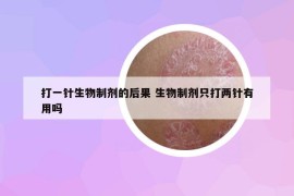 打一针生物制剂的后果 生物制剂只打两针有用吗
