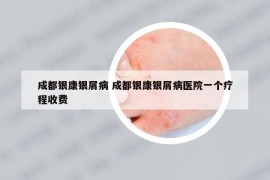 成都银康银屑病 成都银康银屑病医院一个疗程收费