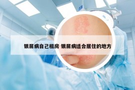 银屑病自己租房 银屑病适合居住的地方