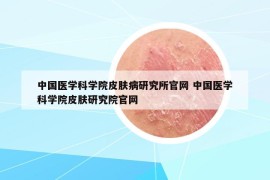 中国医学科学院皮肤病研究所官网 中国医学科学院皮肤研究院官网