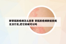 脚掌跖脓疱病怎么回事 掌跖脓疱病脚底脓疱无法行走,把它挑破可以吗