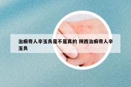 治癣奇人辛玉良是不是真的 陕西治癣奇人辛玉良
