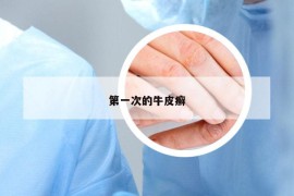 第一次的牛皮癣