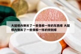 大腿根内侧长了一些像癣一样的东西痒 大腿根内侧长了一些像癣一样的特别痒