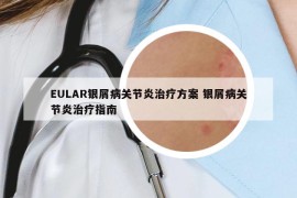 EULAR银屑病关节炎治疗方案 银屑病关节炎治疗指南