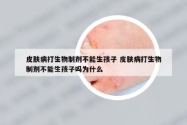 皮肤病打生物制剂不能生孩子 皮肤病打生物制剂不能生孩子吗为什么