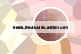 贵州铜仁医院皮肤科 铜仁地区医院皮肤科