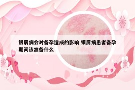 银屑病会对备孕造成的影响 银屑病患者备孕期间该准备什么