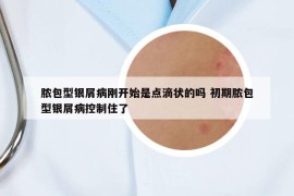脓包型银屑病刚开始是点滴状的吗 初期脓包型银屑病控制住了