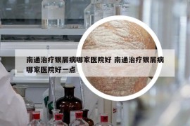 南通治疗银屑病哪家医院好 南通治疗银屑病哪家医院好一点