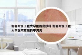 邯郸附属工程大学医院皮肤科 邯郸附属工程大学医院皮肤科甲沟炎