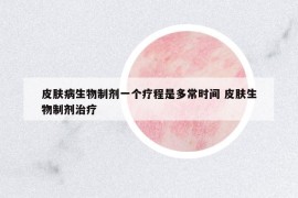 皮肤病生物制剂一个疗程是多常时间 皮肤生物制剂治疗