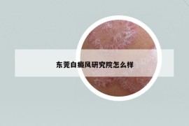 东莞白癜风研究院怎么样