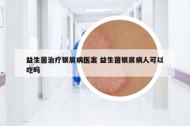 益生菌治疗银屑病医案 益生菌银屑病人可以吃吗