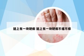 腿上有一块硬癣 腿上有一块硬癣不痛不痒