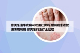 修美乐治牛皮癣可以用社保吗 银屑病患者使用生物制剂 修美乐的治疗全过程