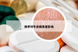 换季对牛皮癣患者影响
