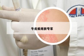 牛皮癣用肤专家