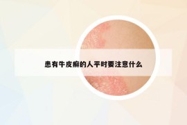 患有牛皮癣的人平时要注意什么