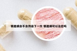 银翘病会不会传染下一代 银翘病可以治愈吗
