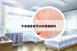 牛皮癣患者可以办理病退吗