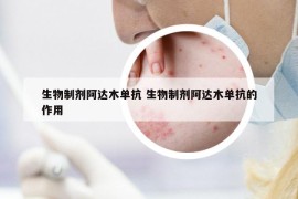 生物制剂阿达木单抗 生物制剂阿达木单抗的作用