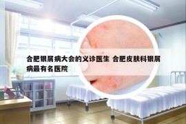 合肥银屑病大会的义诊医生 合肥皮肤科银屑病最有名医院