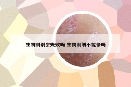 生物制剂会失效吗 生物制剂不能停吗