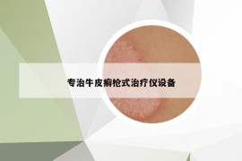 专治牛皮癣枪式治疗仪设备