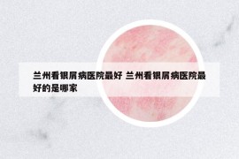 兰州看银屑病医院最好 兰州看银屑病医院最好的是哪家
