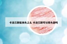 卡泊三醇能抹头上么 卡泊三醇可以擦头部吗