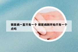 银屑病一直只有一个 银屑病刚开始只有一个点吗