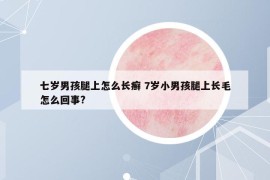 七岁男孩腿上怎么长癣 7岁小男孩腿上长毛怎么回事?