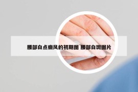 腰部白点癫风的初期图 腰部白斑图片