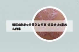 银屑病抗链0高是怎么回事 银屑病抗o是怎么回事