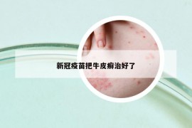 新冠疫苗把牛皮癣治好了