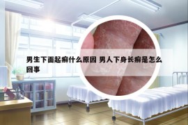 男生下面起癣什么原因 男人下身长癣是怎么回事