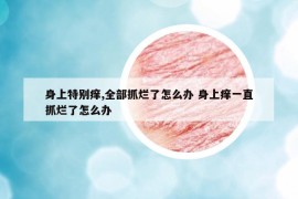 身上特别痒,全部抓烂了怎么办 身上痒一直抓烂了怎么办