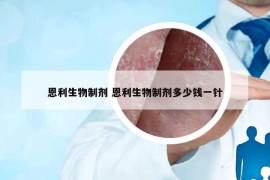 恩利生物制剂 恩利生物制剂多少钱一针