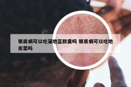 银屑病可以吃蒲地蓝胶囊吗 银屑病可以吃地皮菜吗
