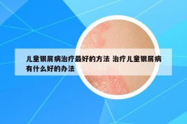 儿童银屑病治疗最好的方法 治疗儿童银屑病有什么好的办法