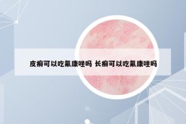 皮癣可以吃氟康唑吗 长癣可以吃氟康唑吗